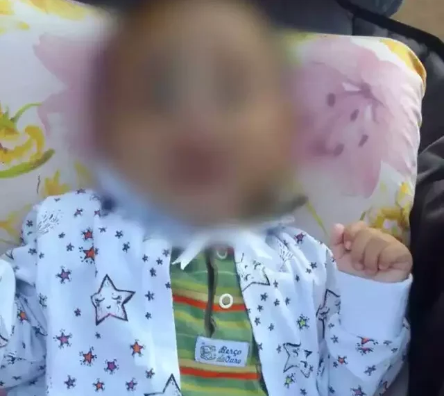 Bebê de 6 meses morre após apresentar hematoma na cabeça e sangramento no nariz