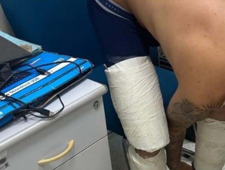 PF prende homem no aeroporto de Corumbá com cocaína nas pernas