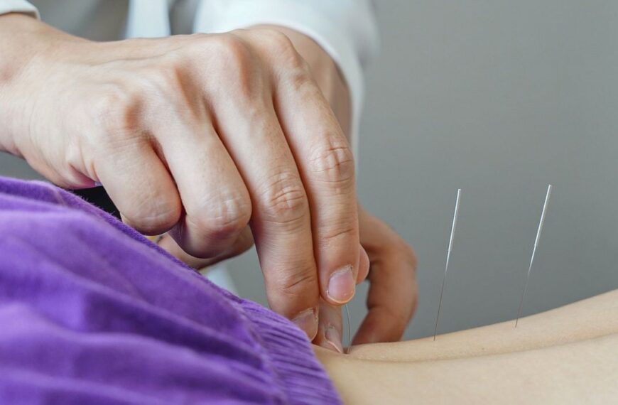 Brasil regulamenta exercício profissional da acupuntura