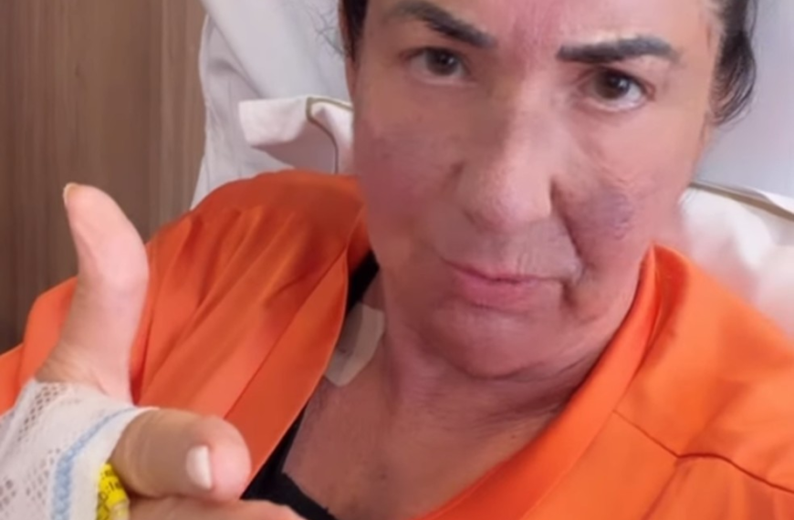 Margareth Serrão faz primeiras cirurgias plásticas aos 60 anos e celebra resultado