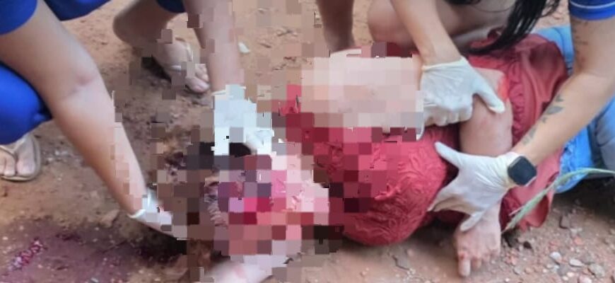 Mulher agredida com marreta pelo marido segue em estado grave em Dourados